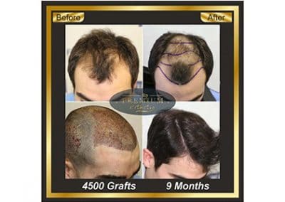 Premium Hair and Aesthetic Center Photos