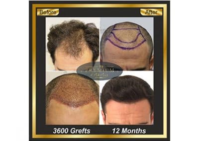 Premium Hair and Aesthetic Center Photos